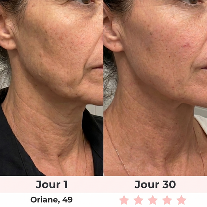 Sculpteur Facial LED 7-en-1 Dalyra