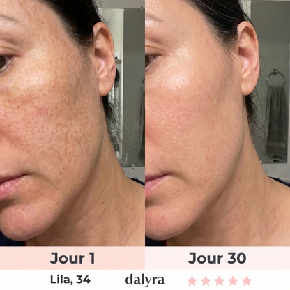 Sculpteur Facial LED 7-en-1 Dalyra