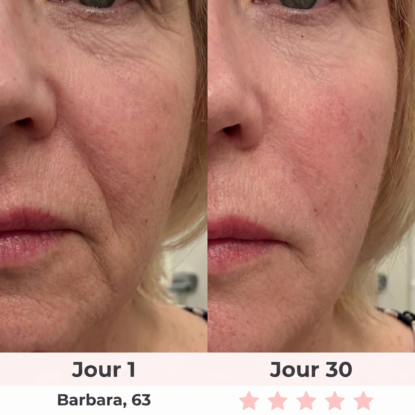 Sculpteur Facial LED 7-en-1 Dalyra