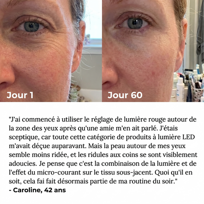 Sculpteur Facial LED 7-en-1 Dalyra